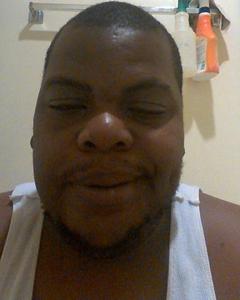 Man, 40. Reco1278
