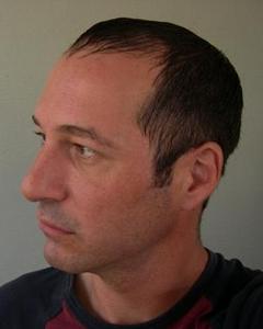 Man, 55. kronikov
