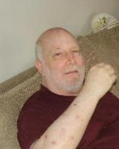 Man, 79. dennis9131945