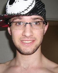 Man, 31. tylonius