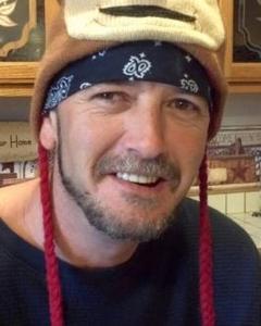Man, 54. Scar3380