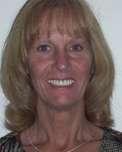 Woman, 73. honbev