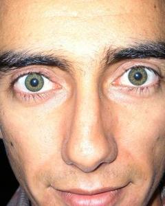 Man, 41. abefor1