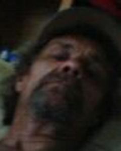 Man, 63. Brench6443