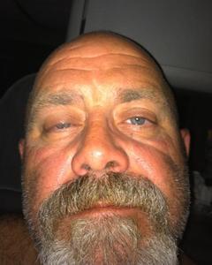 Man, 60. Onionjustforlo