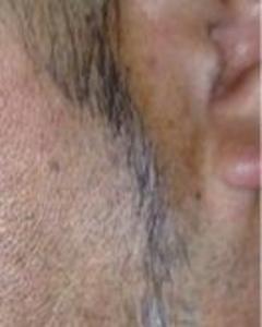 Man, 62. MRB634041