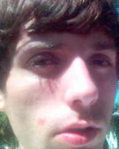 Man, 102. drex420
