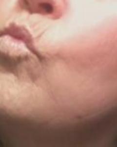 Woman, 72. BB0329