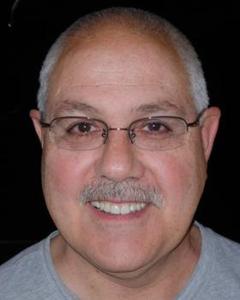 Man, 63. rubrad