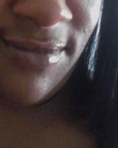 Woman, 41. diseasefreepus